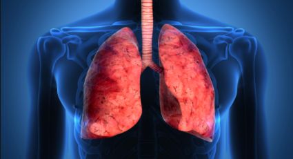 Cáncer de pulmón, entre las enfermedades más señaladas en México