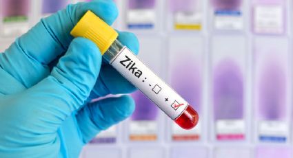 Zika podría afectar la testosterona y testículos, señala estudio 
