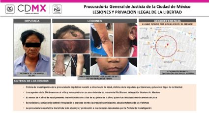 Niños que sufrieron crueldad por su abuela reciben atención médica especializada: PGJ-CDMX