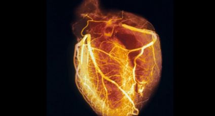 ¿Qué es el Síndrome del corazón roto? 