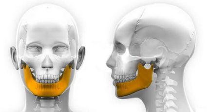Implantan a niño mandíbula creada con impresora 3D