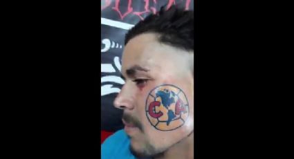 Fanático se tatúa el escudo del América en el rostro (VIDEO)