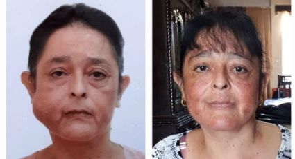 Médicos del IMSS extirpan tumor de la cara de una mujer