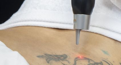 Intenta quitarse un tatuaje con las iniciales de su 'ex' y termina arrepentido (VIDEO)
