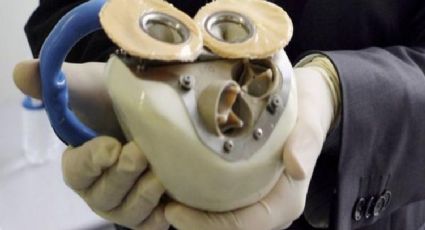 Médicos del IMSS, implantan corazón artificial de manera exitosa