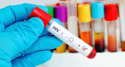 Vacuna VIH: ¿Se está cerca de lograr el objetivo?