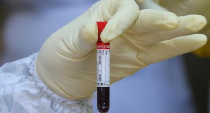 VERDADERO: Sangre tipo O es menos vulnerable a Covid-19