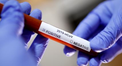 Realizan pruebas en humanos de primera vacuna contra Covid-19