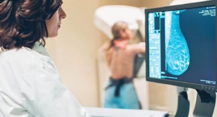 TecNM recibe título de patente para sistema de detección de cáncer de mama