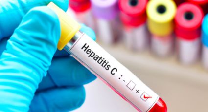 IMSS concluirá el viernes jornada de detección de Hepatitis C e Hipertensión