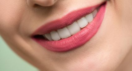 Salud bucal: Conoce el mejor remedio para eliminar el sarro en los dientes