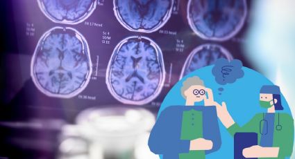 Alzheimer: científicos descubren fármaco potencial para prevenir la enfermedad
