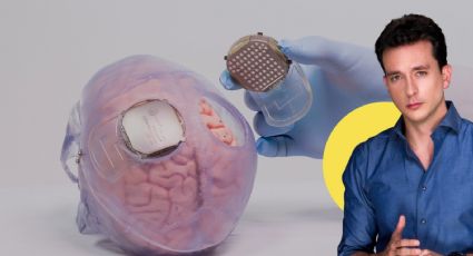 Neuralink comparte video del primer paciente de implante cerebral