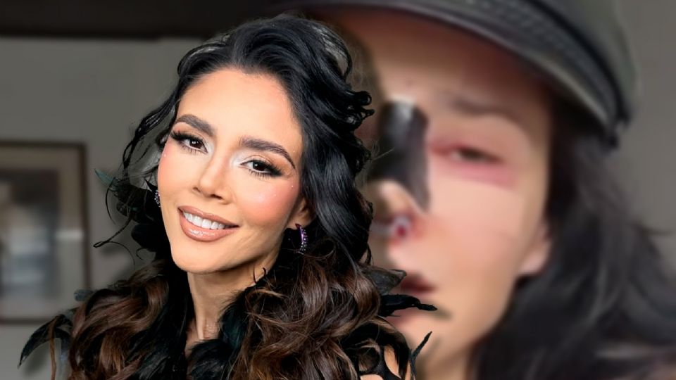 Para Dorismar, el camino es doble: la reconstrucción física en Colombia y la reparación legal en México.