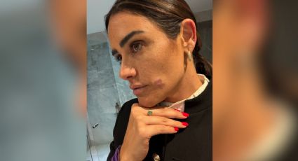 Denuncia Rojo de la Vega agresión en la Zona Rosa