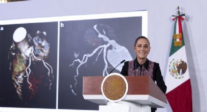 Sheinbaum anuncia salto tecnológico en IMSS, ISSSTE e IMSS-Bienestar
