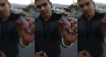 Ladrón le arranca un pedazo de dedo a automovilista