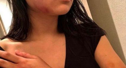 Famoso cantante reconoce haber golpeado a su novia (FOTOS)