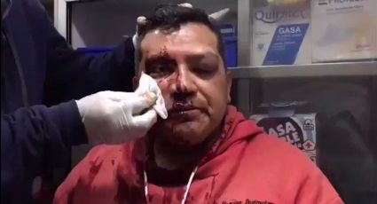 Video muestra agresión de policías contra fotoperiodista en CDMX