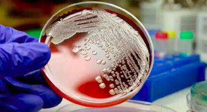 Se esparce por el mundo microbio que provoca infecciones invasivas 