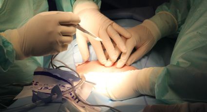 ¿Cirugía laparoscópica hecha por un robot? El autómata logró unir dos extremos del intestino de un cerdo sin ayuda humana