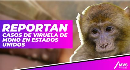 Reportan casos de viruela de Mono en Estados Unidos