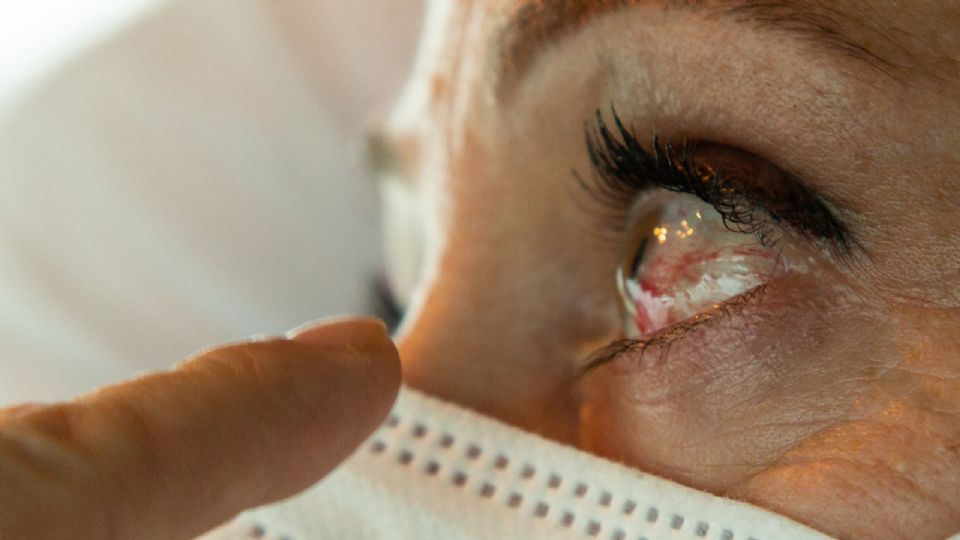Se calcula que en México 1.5 millones de personas padecen glaucoma.