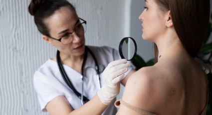 Cáncer en la piel: científicos aseguran haber encontrado una posible cura