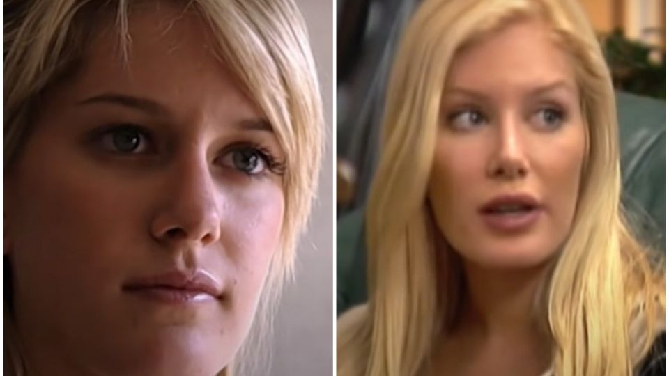 Actriz de la serie “The Hills” declara la tortura que vivió al someterse a 10 cirugías estéticas en un solo día.