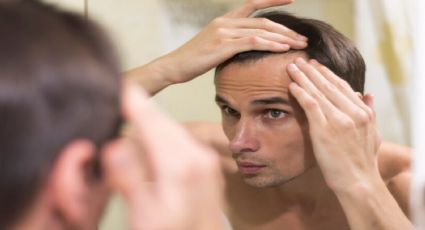 Los mejores tips para prevenir y retrasar las “entradas” de cabello en hombres