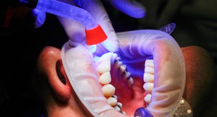 ¿Por qué los dientes se ponen amarillos y cómo se puede quitar?