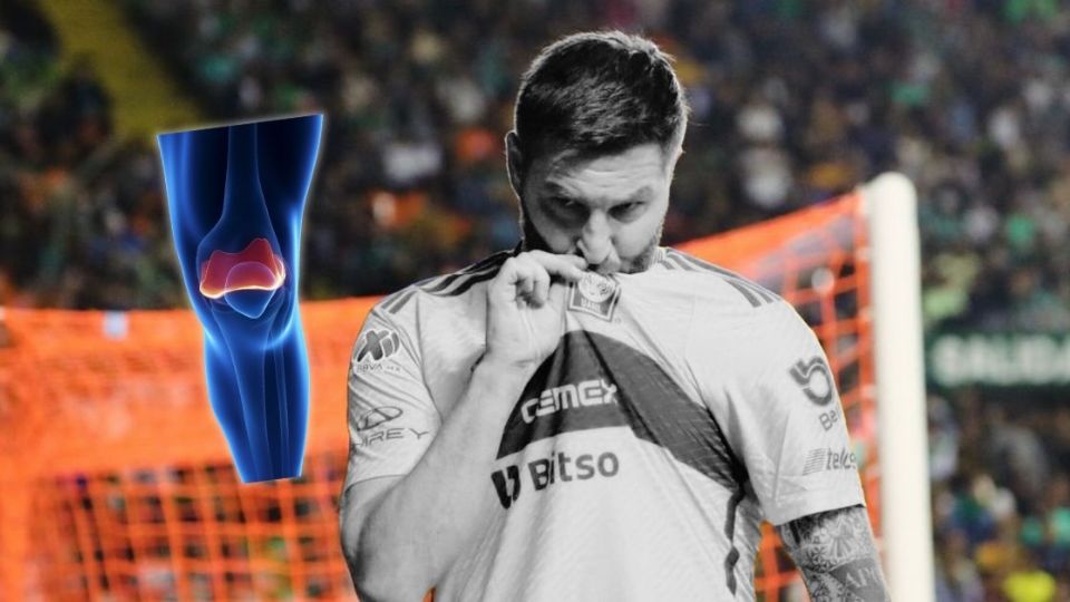 André-Pierre Gignac y una lesión en Tigres UANL que enciende las alarmas