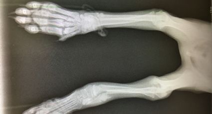 Displasia de cadera y padecimientos ortopédicos