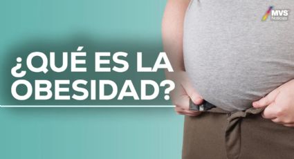 ¿Qué es la obesidad? Expertos abordan perspectivas médicas y nutricionales