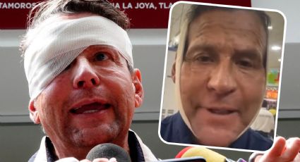 Alfredo Adame despierta preocupación ante su rostro inflamado; explica la razón