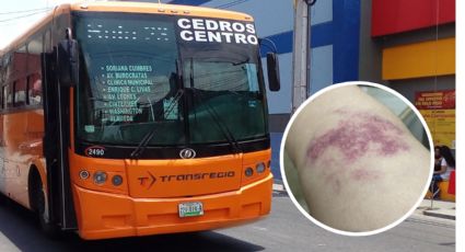 Pasajero resulta herido por ‘frenón’ de la ruta 23 en Monterrey y denuncia en redes