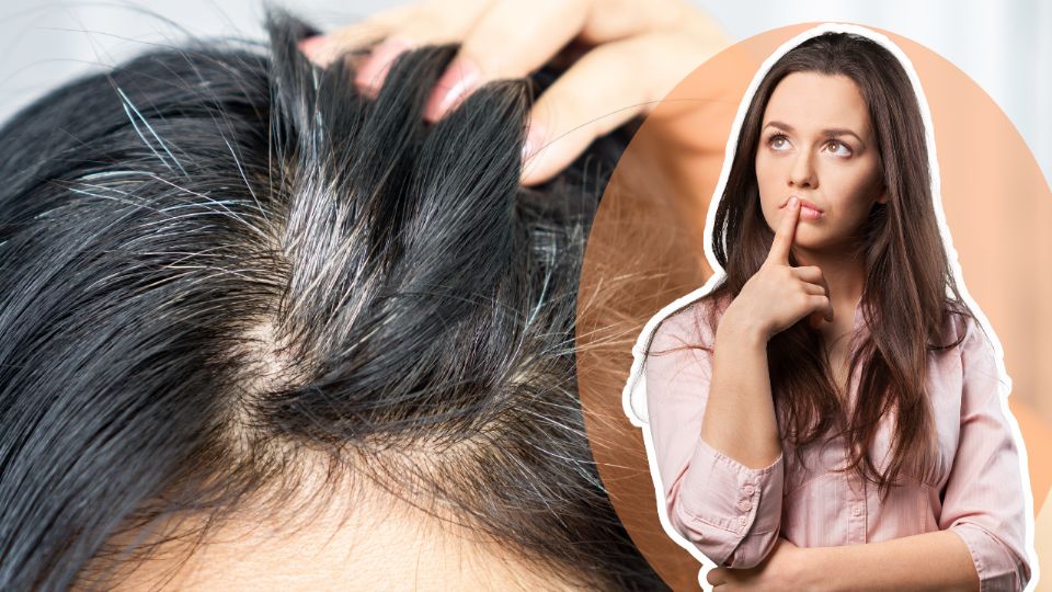 ¿Por qué salen las canas, existe tratamiento para evitarlas?