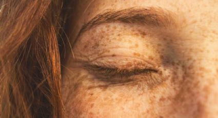 ¿Micropigmentación de pecas? La nueva tendencia de belleza que promueve TikTok