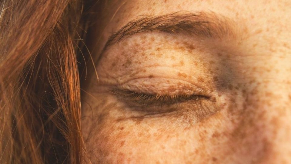 ¿Micropigmentación de pecas? La nueva tendencia de belleza que promueve TiktTok.