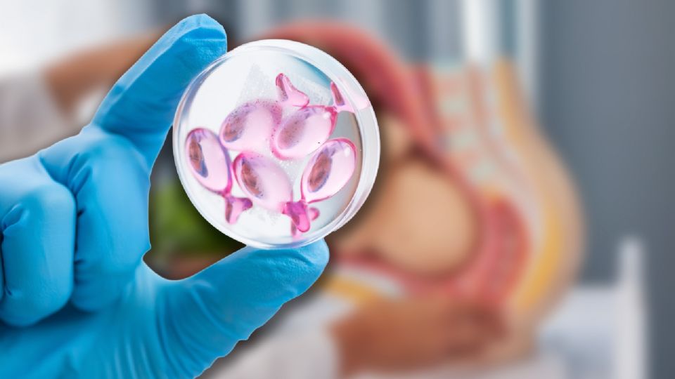 La fertilización in vitro es una opción efectiva y cada vez más accesible para quienes enfrentan problemas de fertilidad.