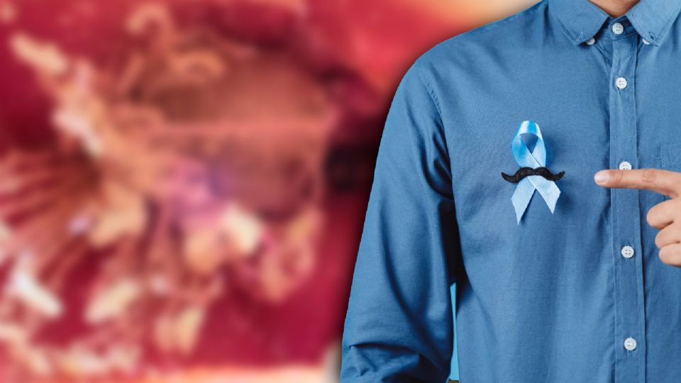 En caso de requerir cirugía, la tecnología ha mejorado significativamente los resultados.