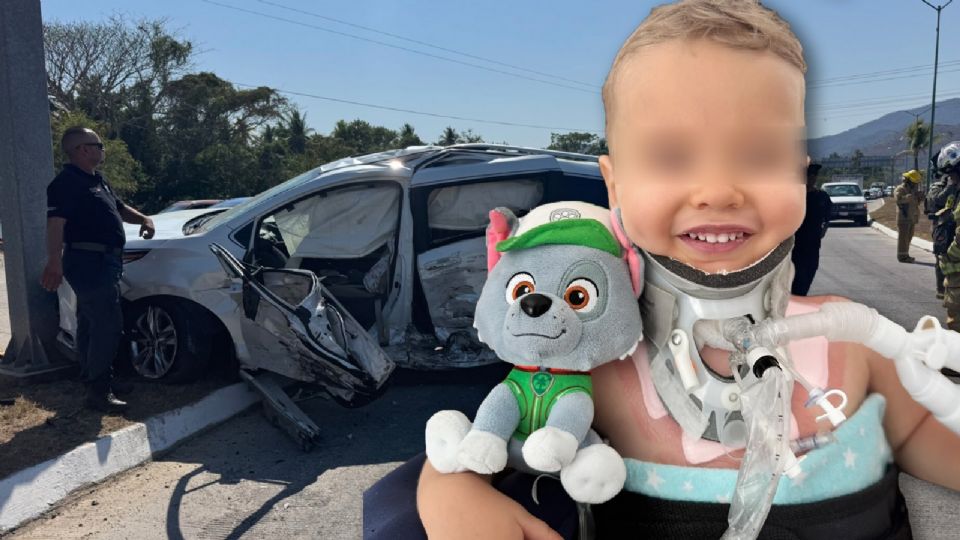 La primera cirugía de Oliver fue posible gracias al apoyo de la fundación del futbolista Toni Kroos, jugador del Real Madrid.