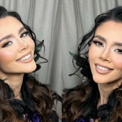 VIDEO | Así quedó el rostro de Dorismar tras una mala cirugía estética