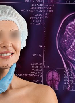 Cirugías estéticas: El caso de una menor y su batalla tras un evento cerebrovascular