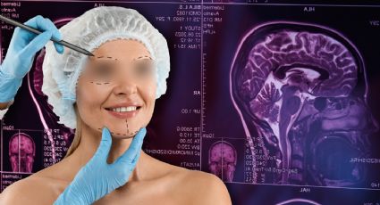 Cirugías estéticas: El caso de una menor y su batalla tras un evento cerebrovascular