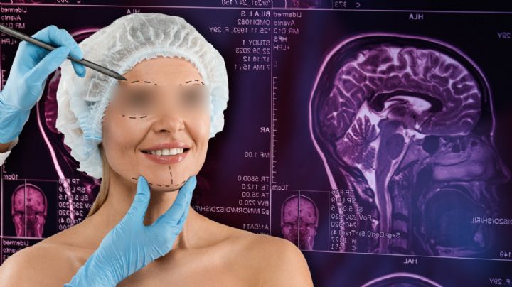 Cirugías estéticas: El caso de una menor y su batalla tras un evento cerebrovascular