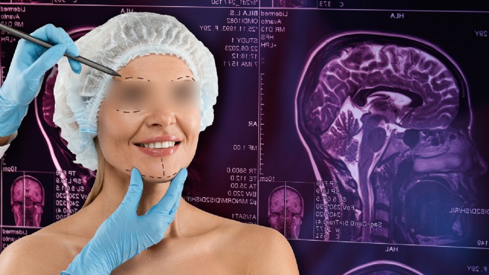 A pesar de las denuncias penales y las amenazas de muerte contra la familia, el 'médico' sigue ofreciendo sus servicios de cirugías estéticas.