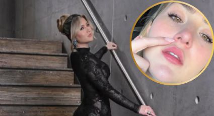 ¿Qué se hizo Melenie Carmona? El retoque estético que generó reacciones en redes