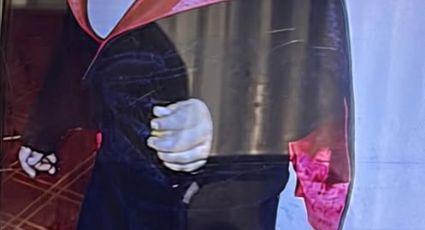 Federico iba por ayuda médica a EE.UU., tras quemarse con una olla de agua hirviendo