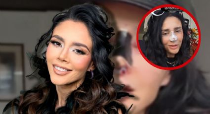 VIDEO | Dorismar reaparece y muestra su rostro tras complicaciones por cirugía estética